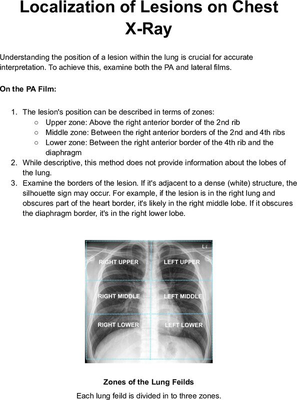 Thumbnail for Localization of Lesions on Chest X-Ray